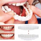 Clear Aligner Treatment