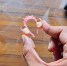 Flexible Denture