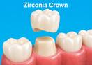 Zirconia Crown